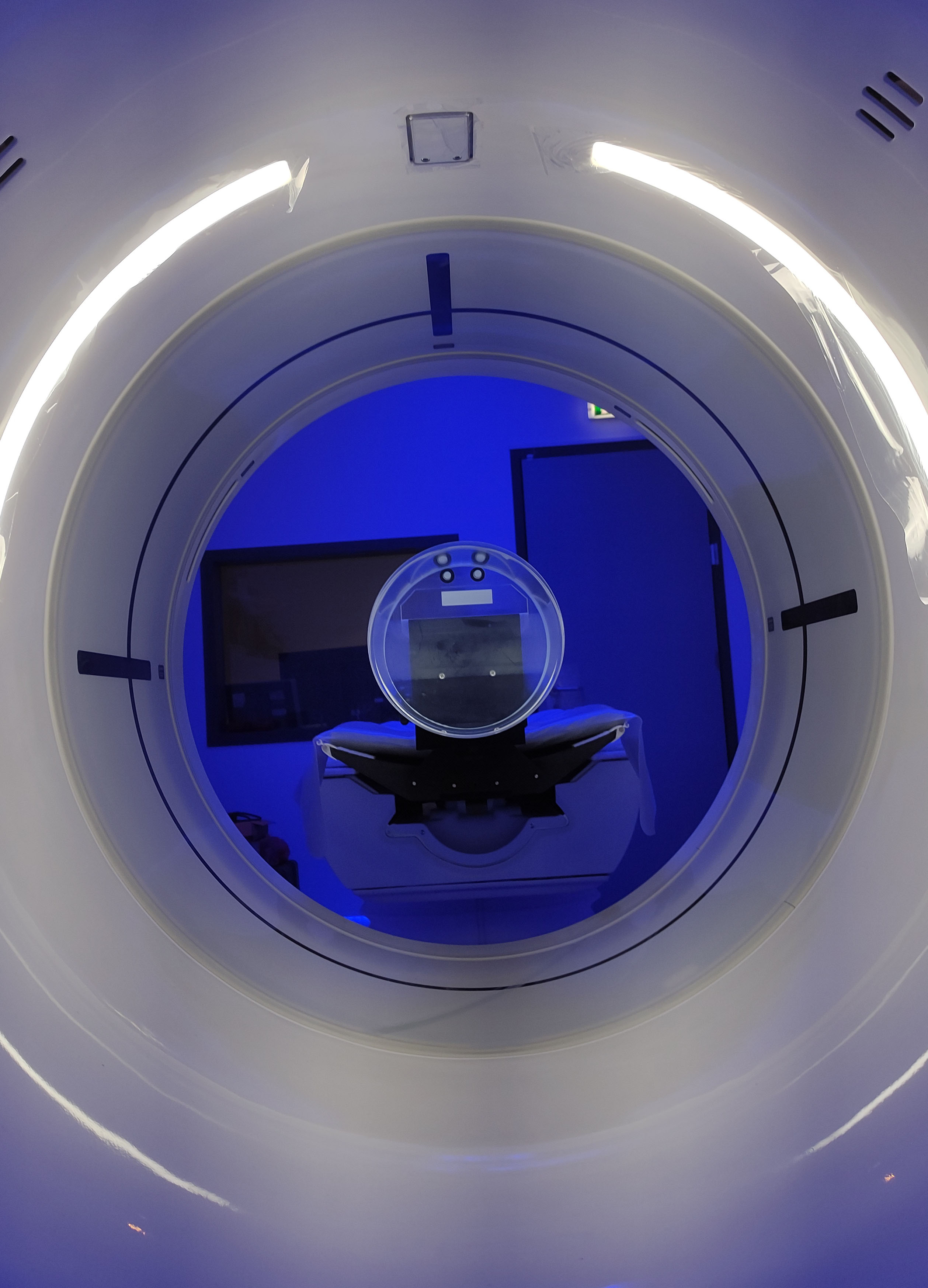 CT Scan Revolution